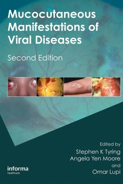 Cover Mucocutaneous Manifestations of Viral Diseases (eBook, PDF)