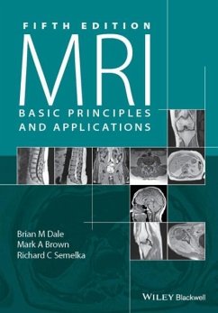 MRI - Dale, Brian M.; Brown, Mark A.; Semelka, Richard C.