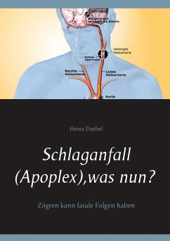 Schlaganfall (Apoplex), was nun? - Duthel, Heinz