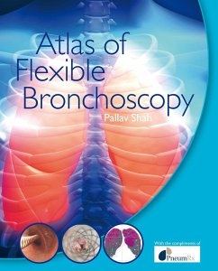 Atlas of Flexible Bronchoscopy (eBook, PDF) - Shah, Pallav