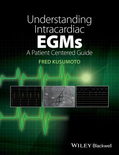Understanding Intracardiac EGMs (eBook, ePUB) - Kusumoto, Fred