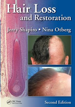 Hair Loss and Restoration (eBook, PDF) - Shapiro, Jerry; Otberg, Nina