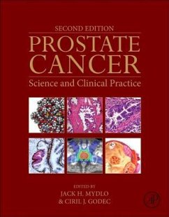 Prostate Cancer