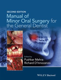 Manual of Minor Oral Surgery for the General Dentist (eBook, PDF) - Mehra, Pushkar; D'Innocenzo, Richard