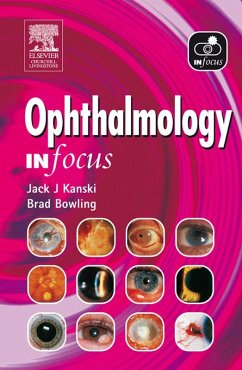 Ophthalmology In Focus (eBook, ePUB) - Kanski, Jack J.; Bowling, Brad