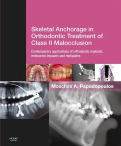 Skeletal Anchorage in Orthodontic Treatment of Class II Malocclusion E-Book (eBook, ePUB) - Papadopoulos, Moschos A.