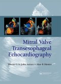 Mitral Valve Transesophageal Echocardiography (eBook, PDF)