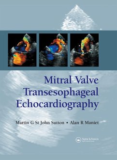 Mitral Valve Transesophageal Echocardiography (eBook, PDF) - St. John Sutton, Martin G.; Maniet, Alan R.