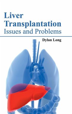 Liver Transplantation