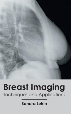 Breast Imaging