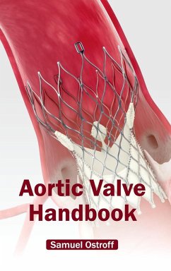 Cover Aortic Valve Handbook