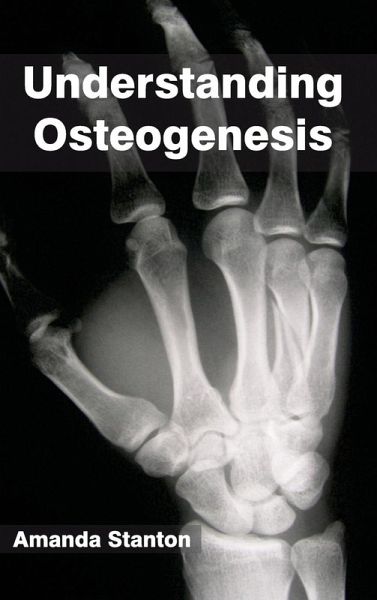 Understanding Osteogenesis Understanding Osteogenesis