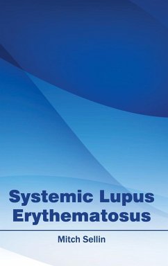 Systemic Lupus Erythematosus