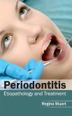 Periodontitis Periodontitis