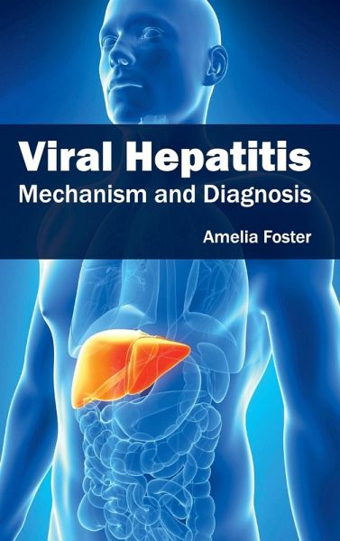 Viral Hepatitis Viral Hepatitis