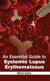 An Essential Guide to Systemic Lupus Erythematosus