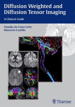 Diffusion Weighted and Diffusion Tensor Imaging