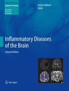 Inflammatory Diseases of the Brain