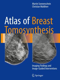 Atlas of Breast Tomosynthesis - Sonnenschein, Martin;Waldherr, Christian