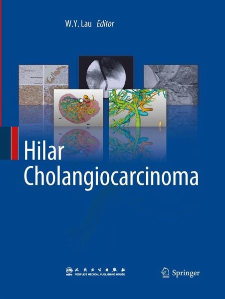 Hilar Cholangiocarcinoma Hilar Cholangiocarcinoma