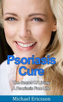 Psoriasis Cure: The Secret Of Living A Psoriasis Free Life (eBook, ePUB) - Ericsson, Michael