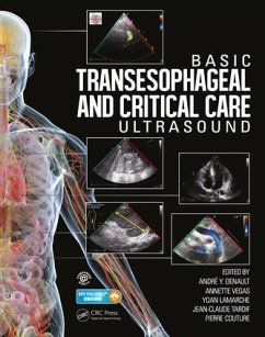 Basic Transesophageal and Critical Care Ultrasound