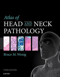 Atlas of Head and Neck Pathology E-Book (eBook, ePUB) - Wenig, Bruce M.