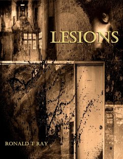 Lesions (eBook, ePUB) - Ray, Ronald T