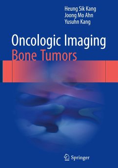 Oncologic Imaging: Bone Tumors - Kang, Heung Sik;Ahn, Joong Mo;Kang, Yusuhn