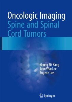 Oncologic Imaging: Spine and Spinal Cord Tumors - Kang, Heung Sik;Lee, Joon Woo;Lee, Eugene
