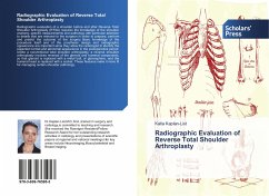 Radiographic Evaluation of Reverse Total Shoulder Arthroplasty - Kaplan-List, Katia