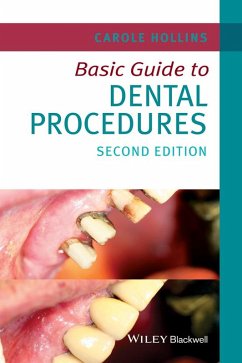 Basic Guide to Dental Procedures (eBook, ePUB) - Hollins, Carole