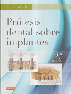 Prótesis dental sobre implantes - Misch, Carl E.