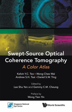 SWEPT-SOURCE OPTICAL COHERENCE TOMOGRAPHY - Teo, Kelvin Y C; Wong, Chee Wai; Tsai, Andrew S H