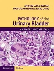 Pathology of the Urinary Bladder - Lopez-Beltran, Antonio; Montironi, Rodolfo; Cheng, Liang