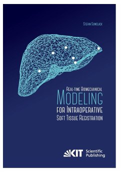 Real-time Biomechanical Modeling for Intraoperative Soft Tissue Registration - Suwelack, Stefan