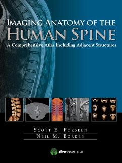 Imaging Anatomy of the Human Spine - Forseen, Scott E; Borden, Neil M