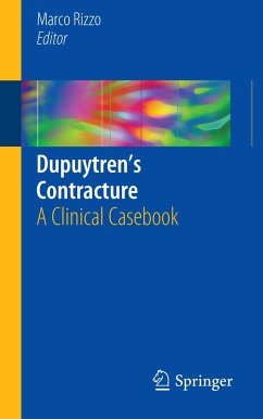 Dupuytren¿s Contracture