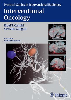 Interventional Oncology - Gandhi, Ripal T.;Ganguli, Suvranu
