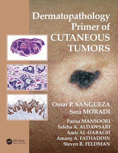 Dermatopathology Primer of Cutaneous Tumors (eBook, PDF) Dermatopathology Primer of Cutaneous Tumors (eBook, PDF)