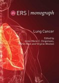 Lung Cancer (eBook, PDF) Lung Cancer (eBook, PDF)