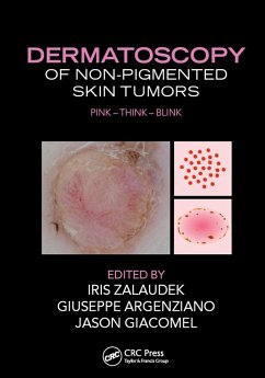 Dermatoscopy of Non-Pigmented Skin Tumors (eBook, PDF)