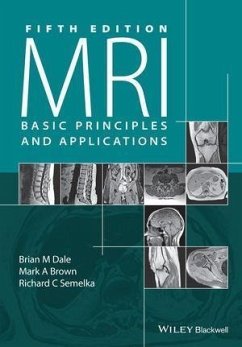 MRI (eBook, ePUB) - Dale, Brian M.; Brown, Mark A.; Semelka, Richard C.