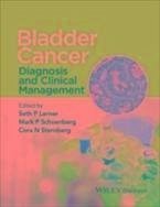 Cover Bladder Cancer (eBook, ePUB)