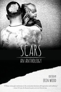 Scars