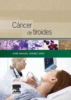Cáncer de tiroides (eBook, ePUB) - Sáez, José Manuel Gómez