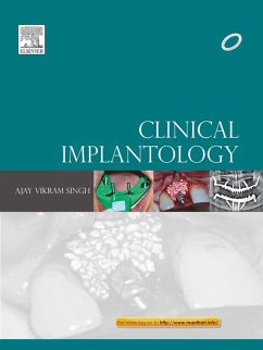 Cover Clinical Implantology (eBook, ePUB)