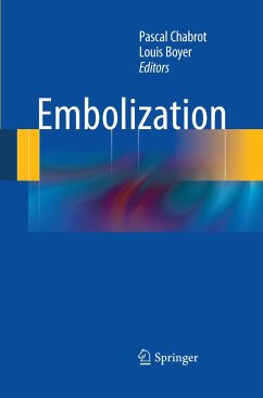 Embolization