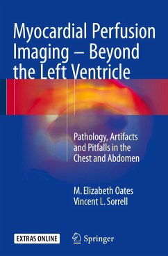 Myocardial Perfusion Imaging - Beyond the Left Ventricle - Oates, M. Elizabeth;Sorrell, Vincent L.