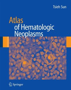 Atlas of Hematologic Neoplasms (eBook, PDF) - Sun, Tsieh